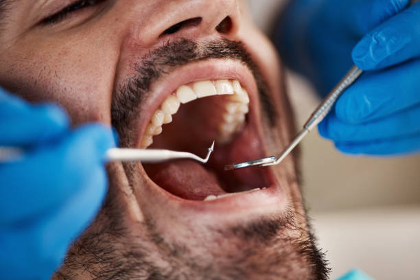 Emergency Dental Services in Indian Lake, MO